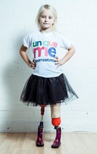 Папа восьмилетней модели: Она станет самой знаменитой в мире девочкой без ног